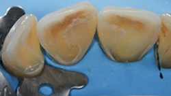 Rondoflex-Plus_fig3_fr.jpg