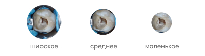 Frame 2.jpg