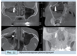 Седов-11.jpg Седов-11.jpg