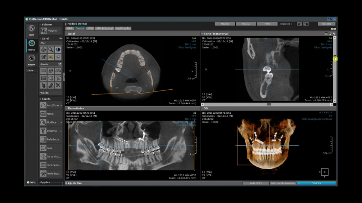 OnDemand3D (2).jpg