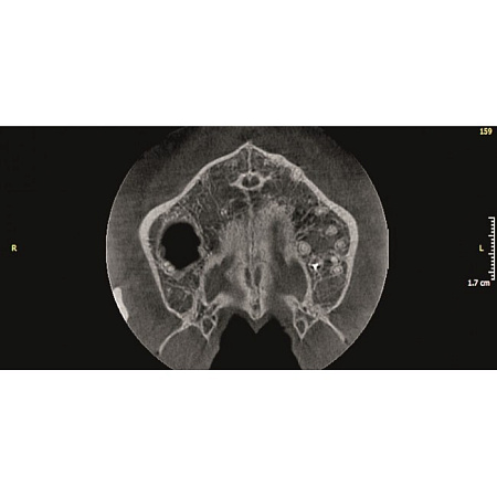 KaVo Pan eXam Plus 2D - датчик для панорамной рентгенодиагностики